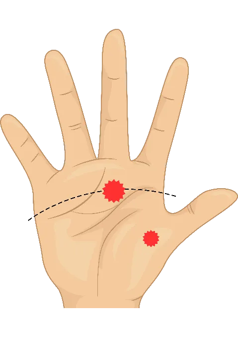 Réflexologie, Acupression et huiles essentielles au service des jeunes ! Zone Reflexe Main Droite